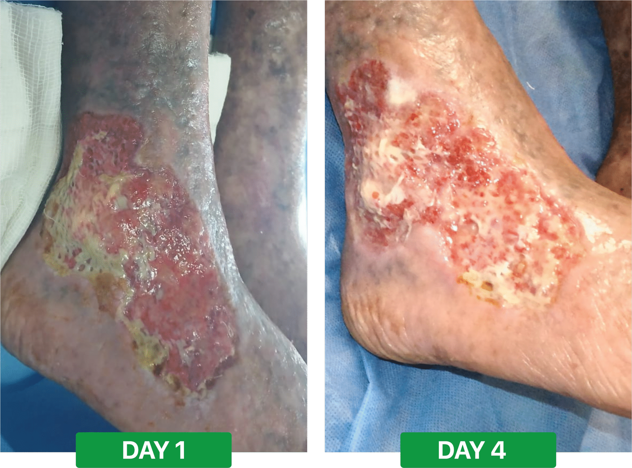 2c92a037bf998d154ebfba994f08a252c8127bc2