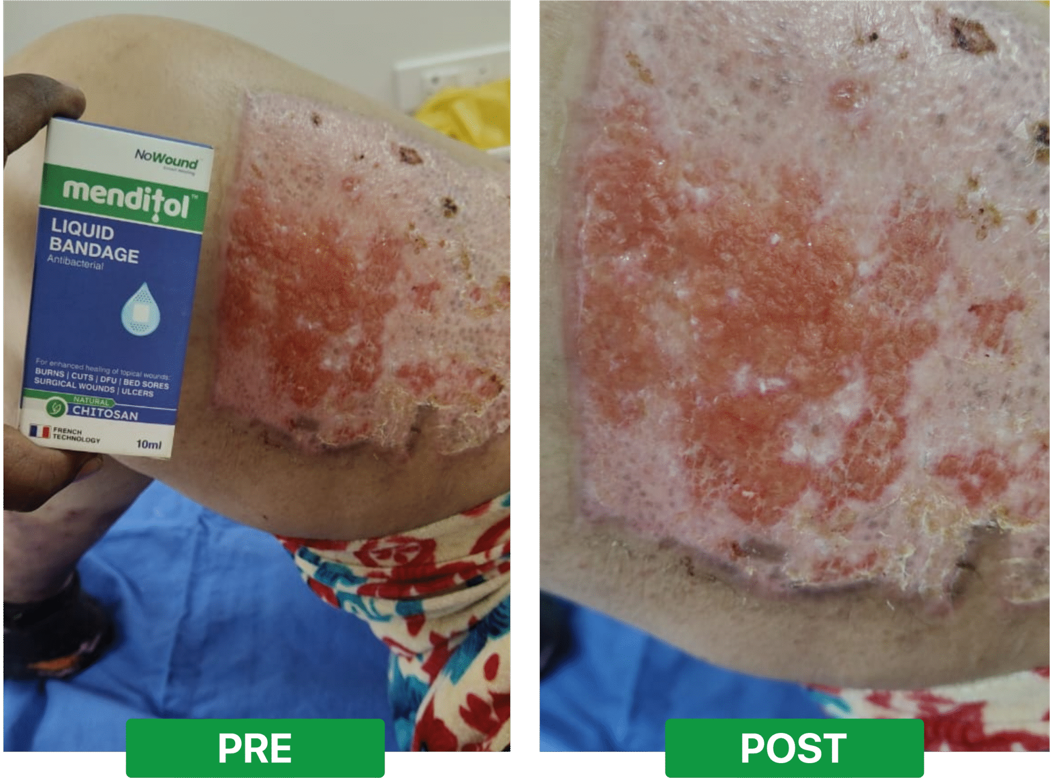 e93f26f99f4c7550aee035a365f61268d1fefeca